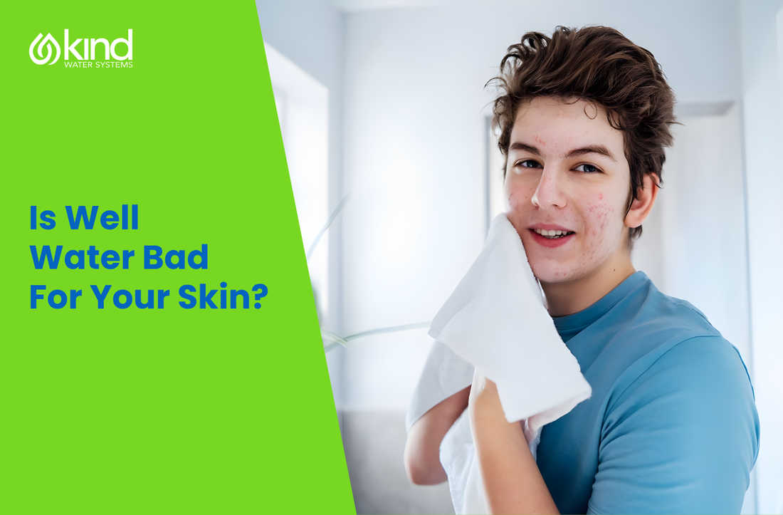Is Well Water Bad For Your Skin?
