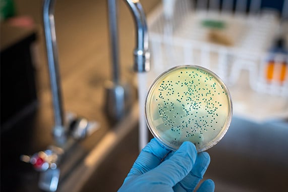 petri dish with microorganisms found in water